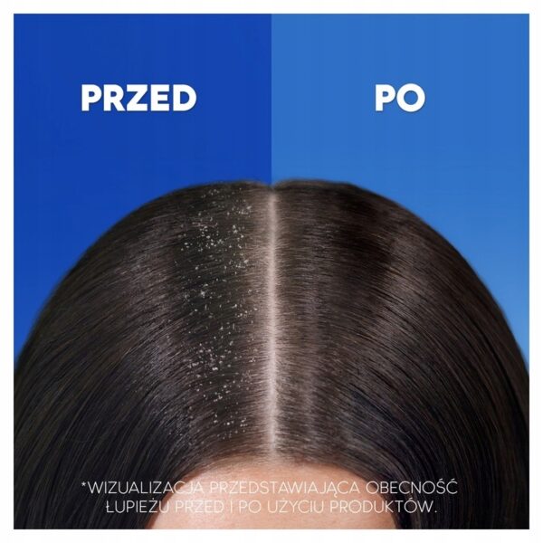 Head & Shoulders 360ml Dry Scalp szampon do włosów przeciwłupieżowy - obrazek 2